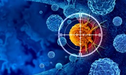 AI, cancer detection, healthcare